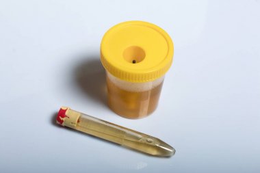 人對氧磷酶1(PON1)酶聯免疫elisa試劑盒