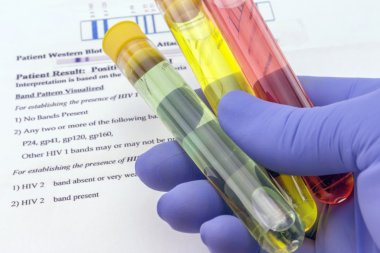 人乳頭瘤病毒18型L1蛋白(HPV18 L1 protein)ELISA試劑盒 人乳頭瘤病毒18型L1蛋白(HPV18 L1 protein)ELISA試劑盒
